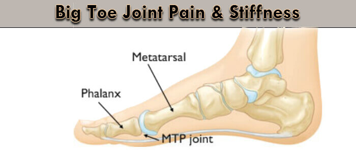 Big Toe Joint Pain, Diagnose, Treatment